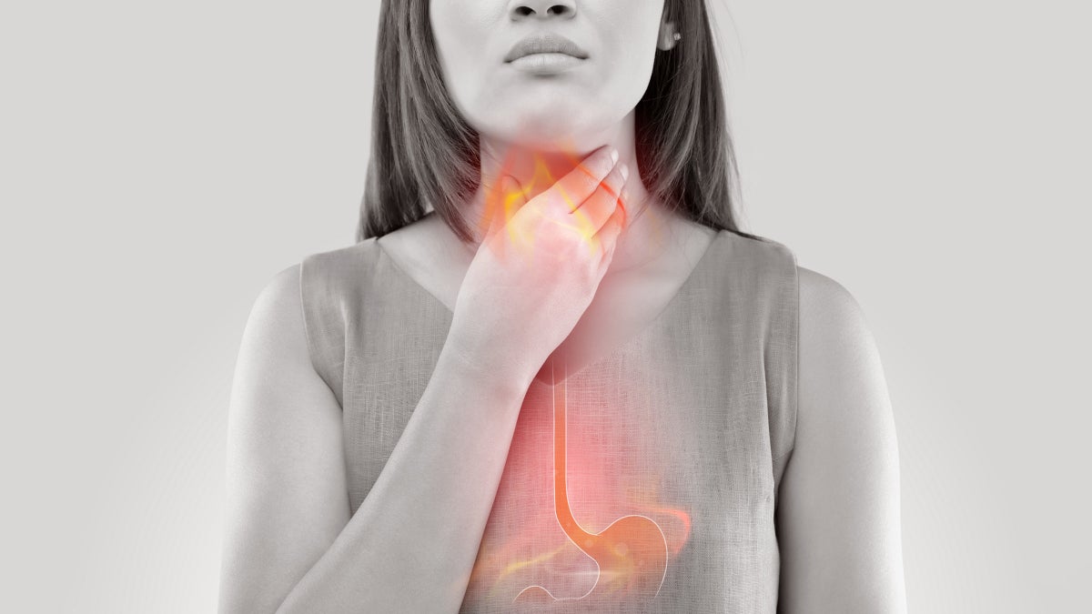 How to Eat Well for Acid Reflux