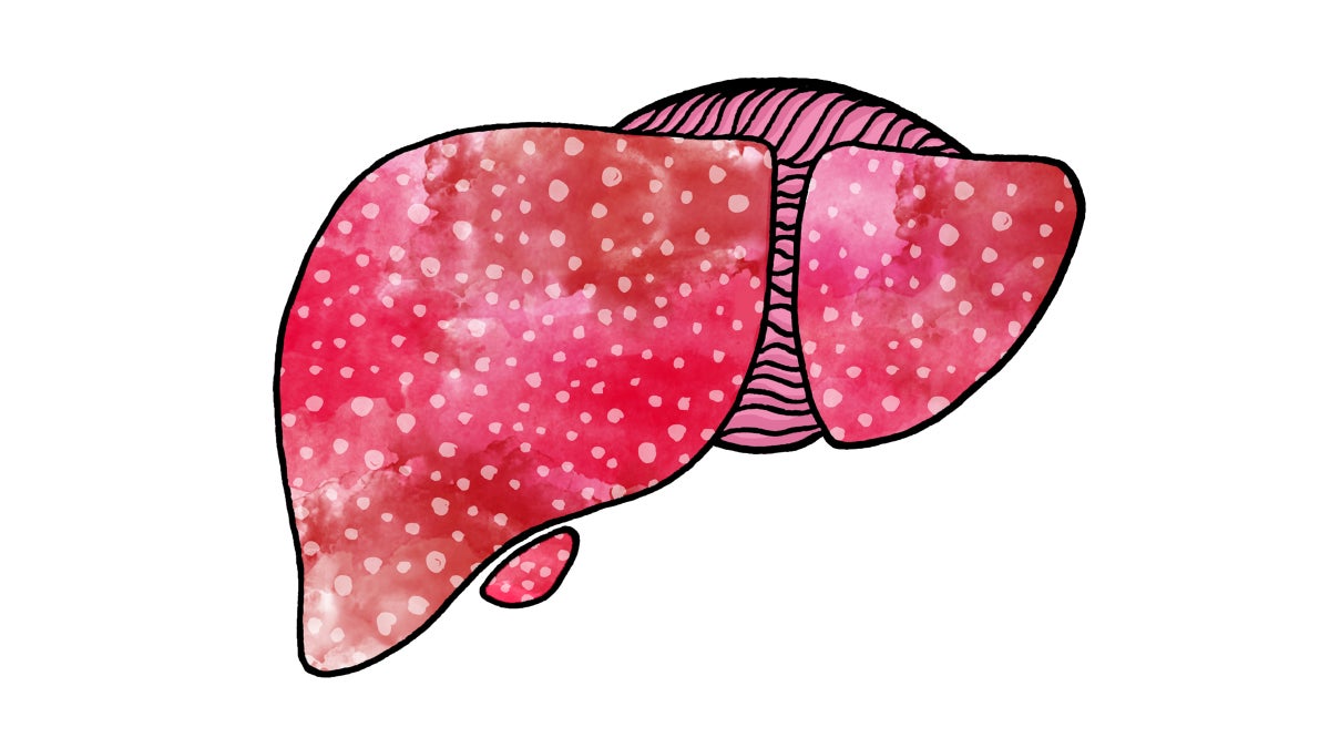 5 Ways You Might Be Hurting Your Liver